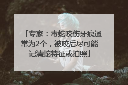 专家：毒蛇咬伤牙痕通常为2个，被咬后尽可能记清蛇特征或拍照
